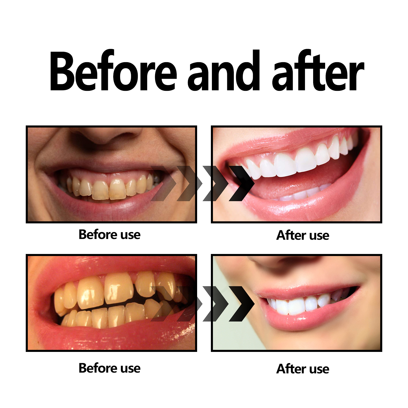Activated Coconut Charcoal Too - Teeth Whitening Charcoal 리뷰 및 가격