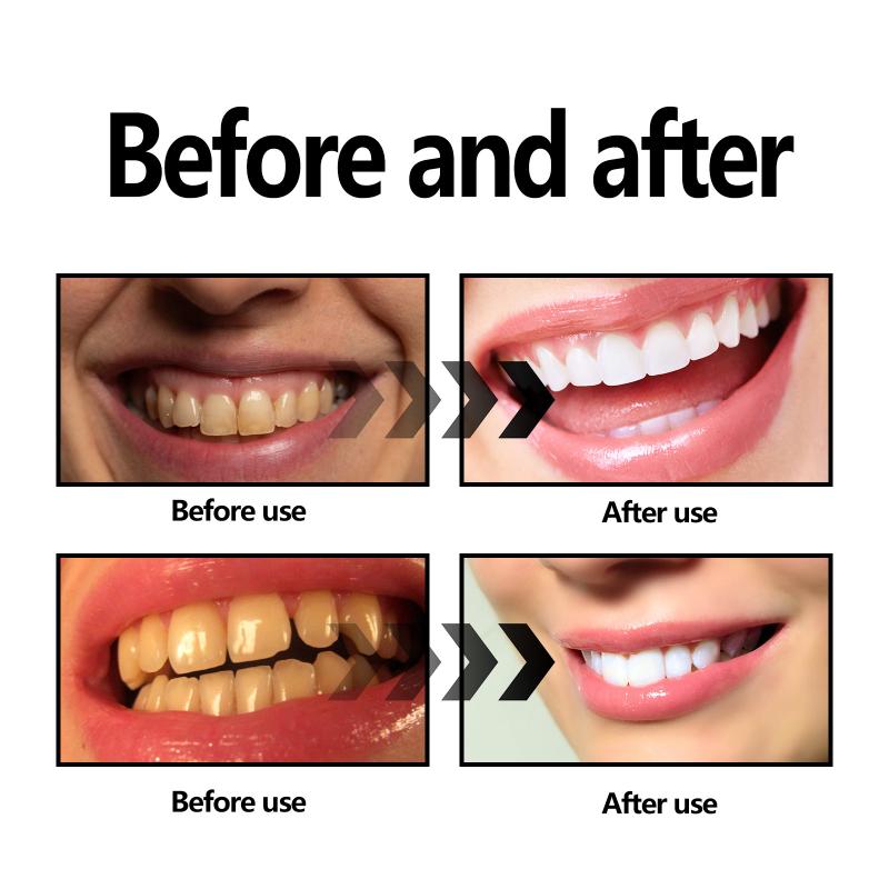 Teeth Whitening Powder Charcoa - Teeth Whitening Filter 리뷰 및 가격