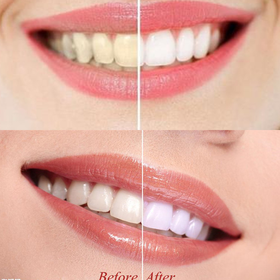 Bamboo Charcoal Teeth Tooth De - Teeth Whitening App 리뷰 및 가격