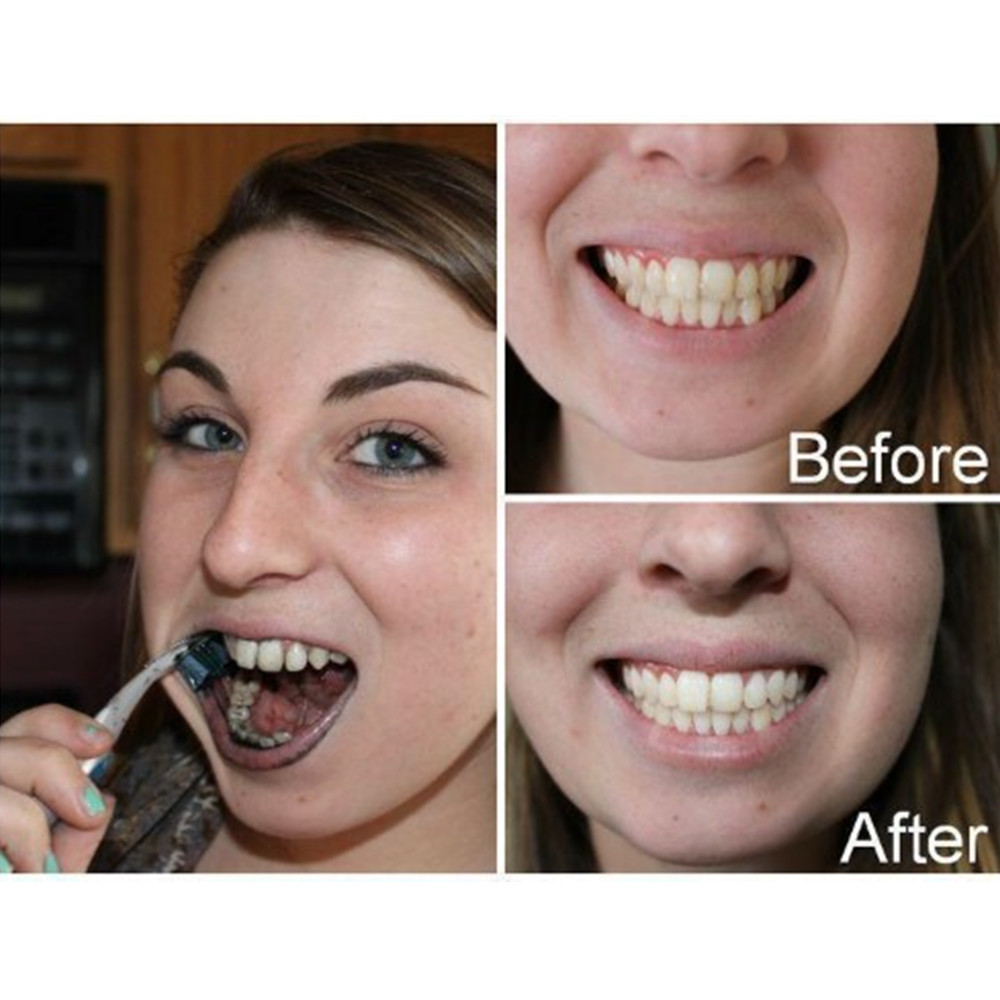 Bamboo Charcoal Teeth Tooth De - Teeth Whitening App 리뷰 및 가격
