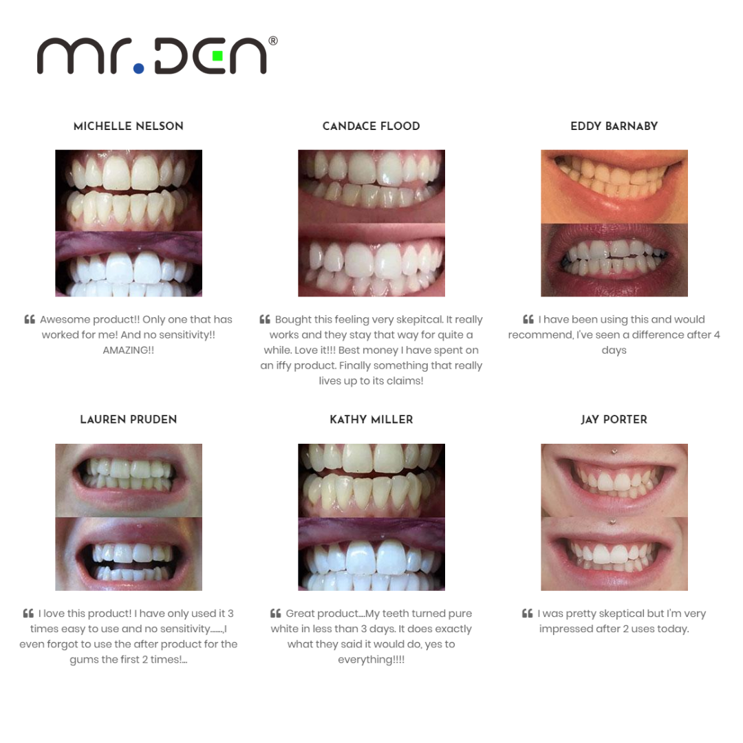 Dr. Whiten 3 Pack Teeth Whiten - Teeth Whitening Kit 리뷰 및 가격