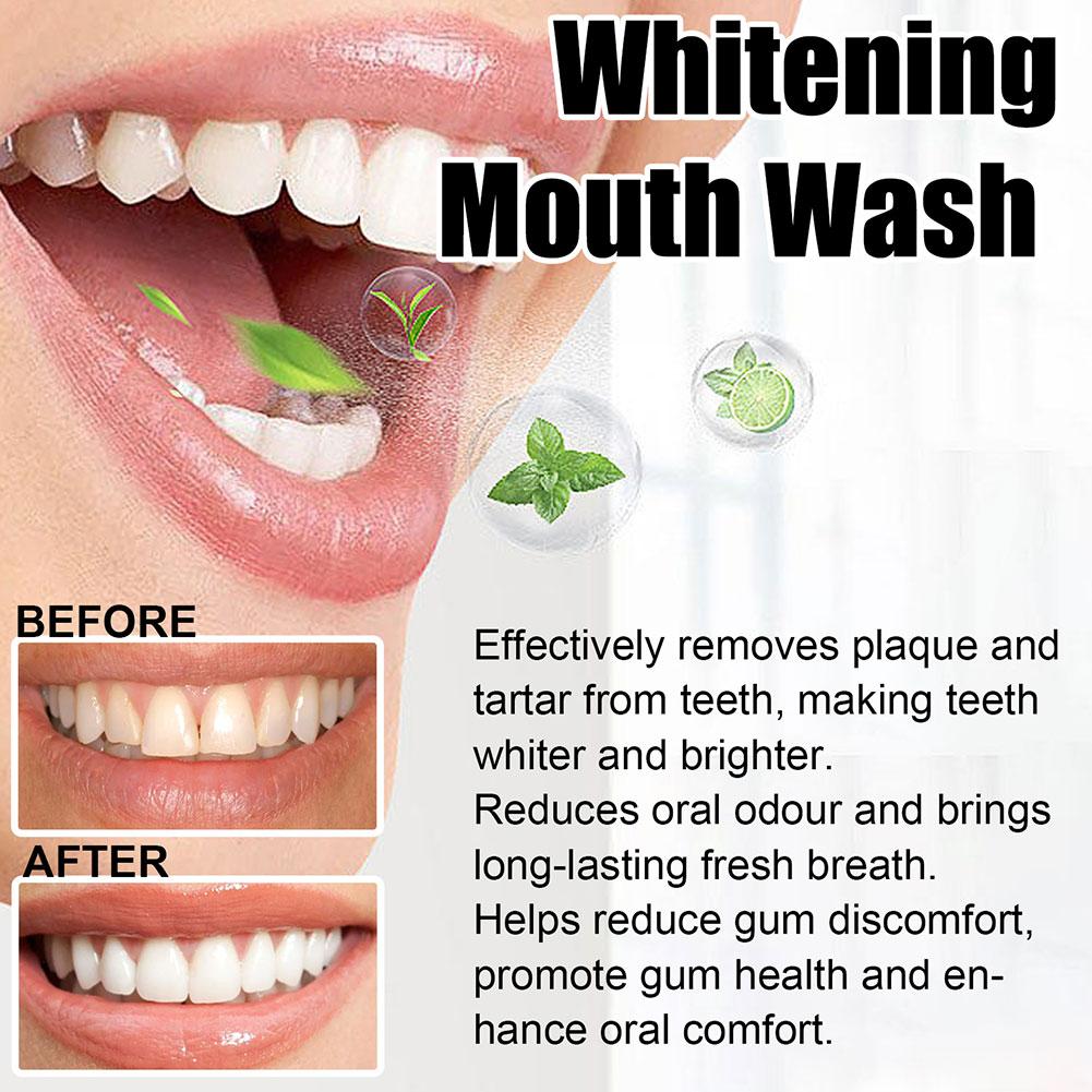 Coconut Mint Pulling Oil Mouth - Teeth Whitening Oil Pulling 리뷰 및 가격