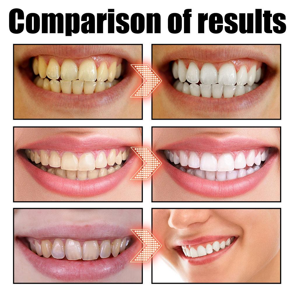 Coconut Mint Pulling Oil Mouth - Teeth Whitening Oil Pulling 리뷰 및 가격