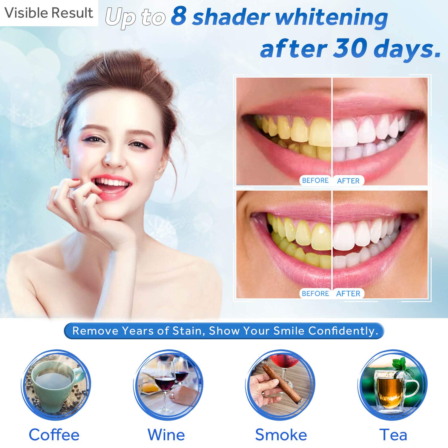 Teeth Whitening Gel Refill Syr - Teeth Whitening App 리뷰 및 가격