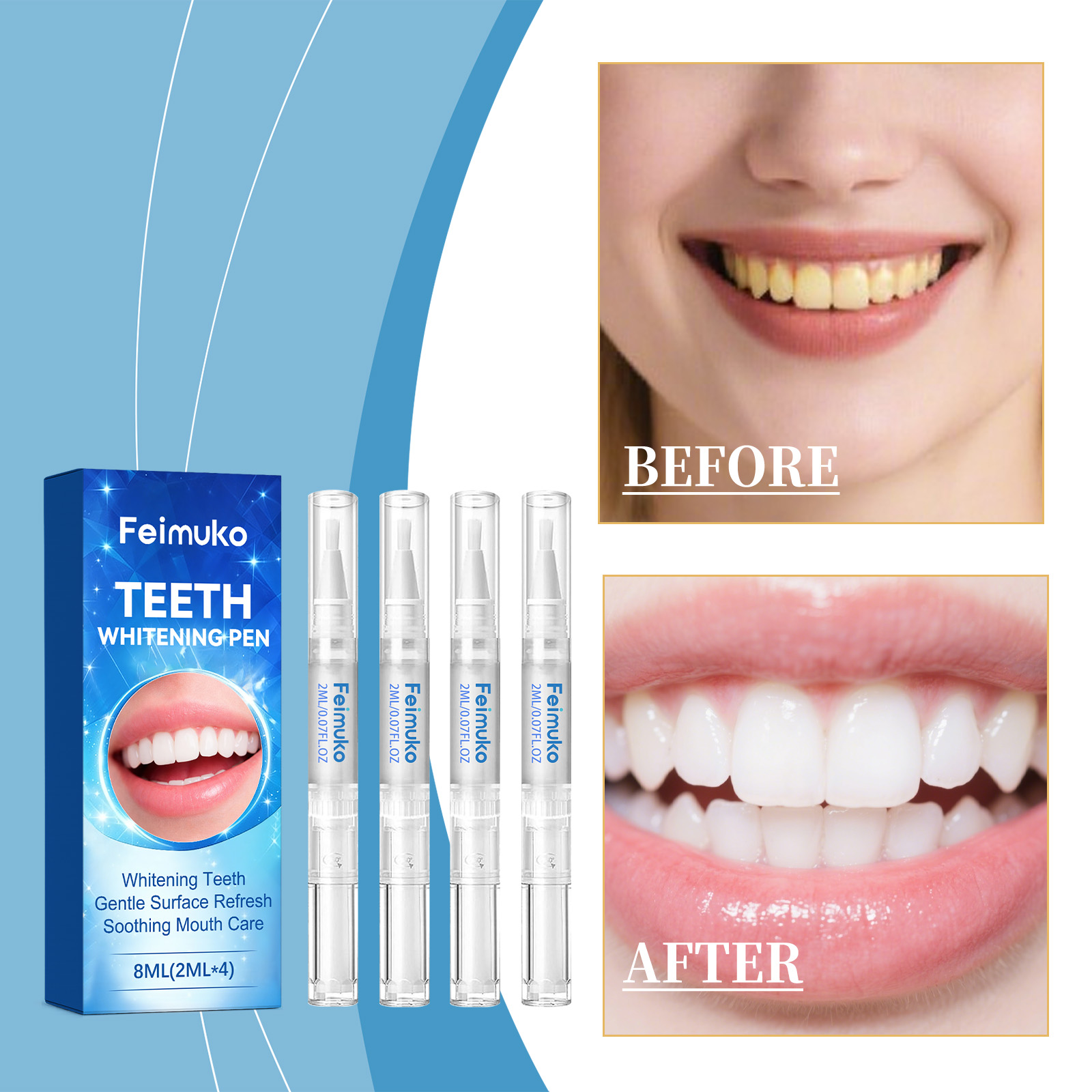 Feimuko 8ml Teeth Gel Pen Gent - Teeth Whitening App 리뷰 및 가격