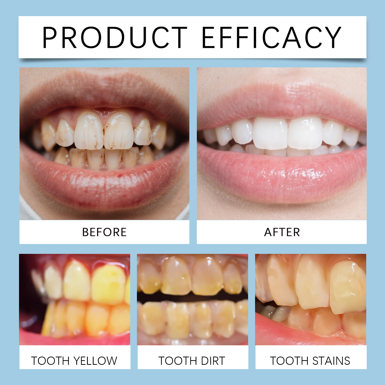 Feimuko 8ml Teeth Gel Pen Gent - Teeth Whitening App 리뷰 및 가격