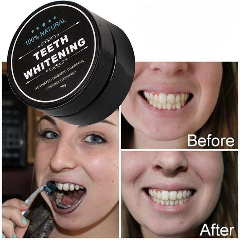 1 Box Activated Charcoal Teeth - Teeth Whitening Charcoal 리뷰 및 가격