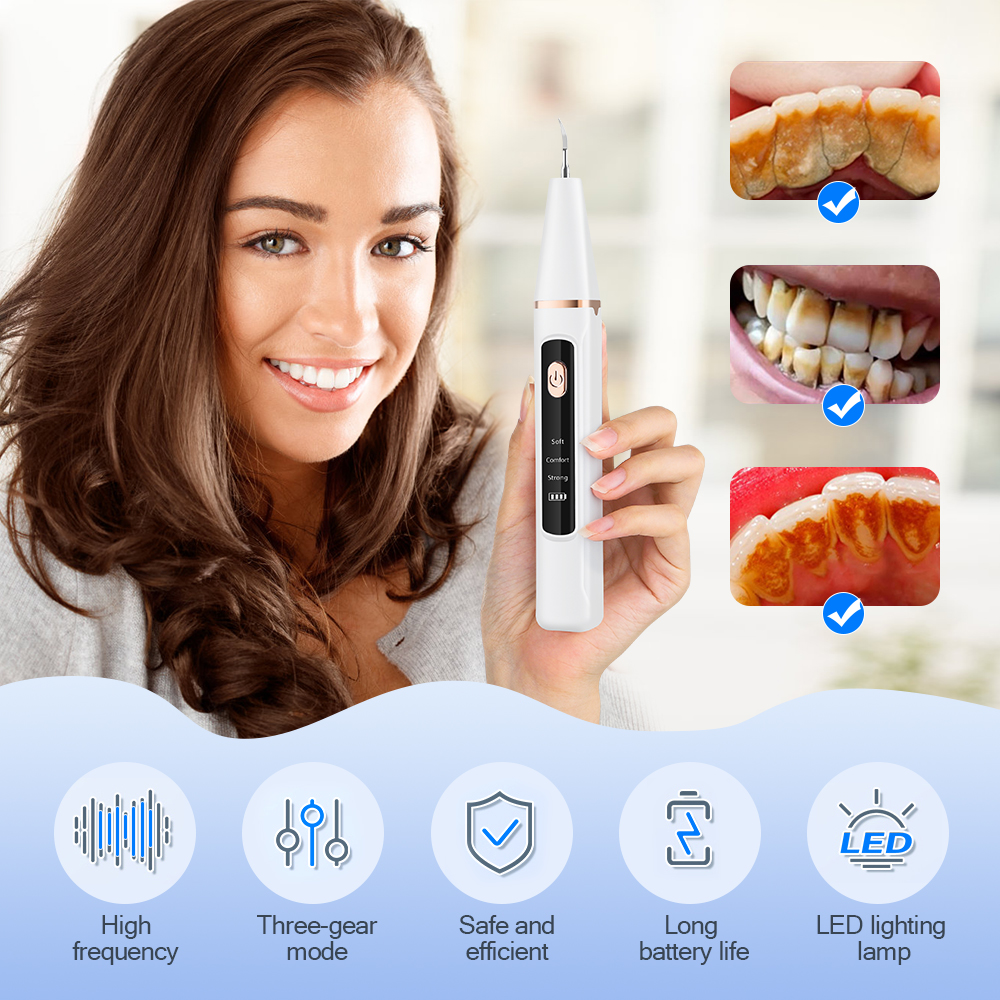Ultrasonic Dental Calculus Rem - Teeth Whitening Kit 리뷰 및 가격