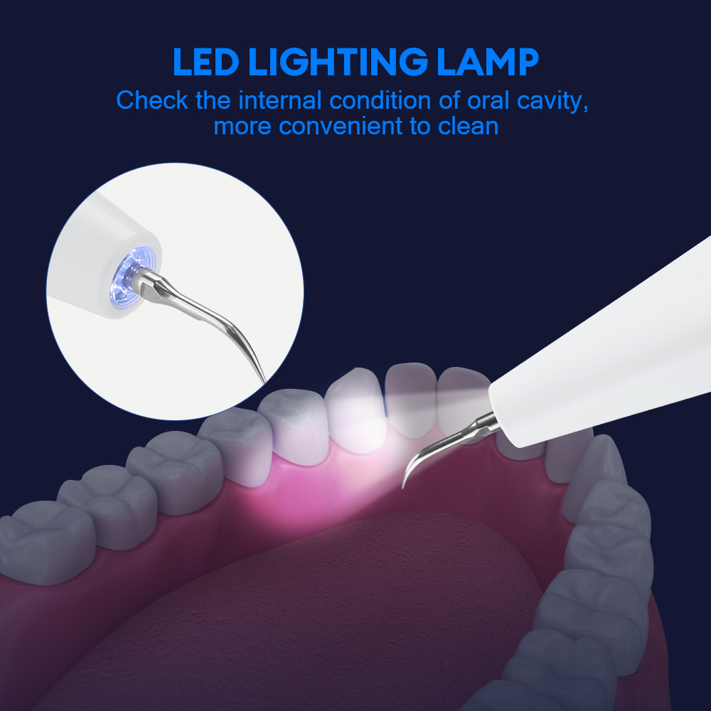 Ultrasonic Dental Calculus Rem - Teeth Whitening Kit 리뷰 및 가격