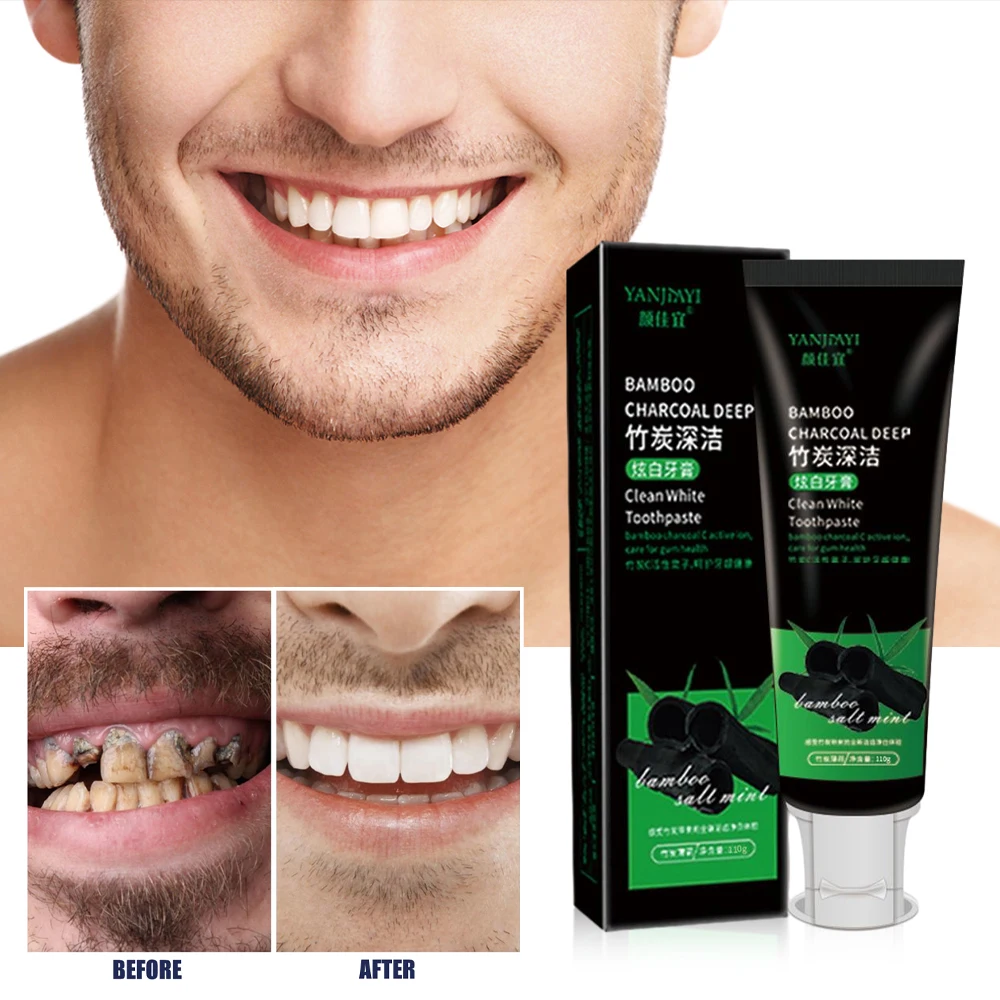 110g Bamboo Charcoal Black Too - Teeth Whitening Charcoal 리뷰 및 가격