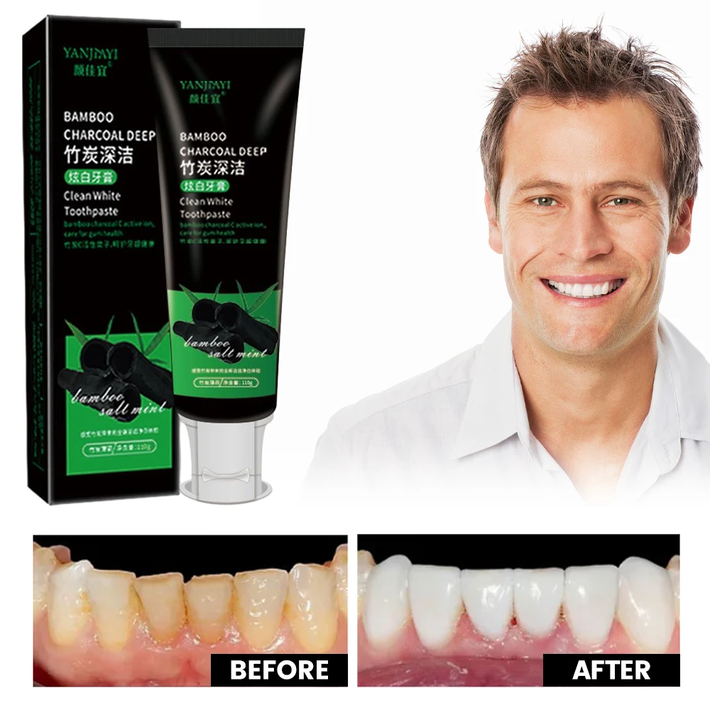 110g Bamboo Charcoal Black Too - Teeth Whitening Charcoal 리뷰 및 가격
