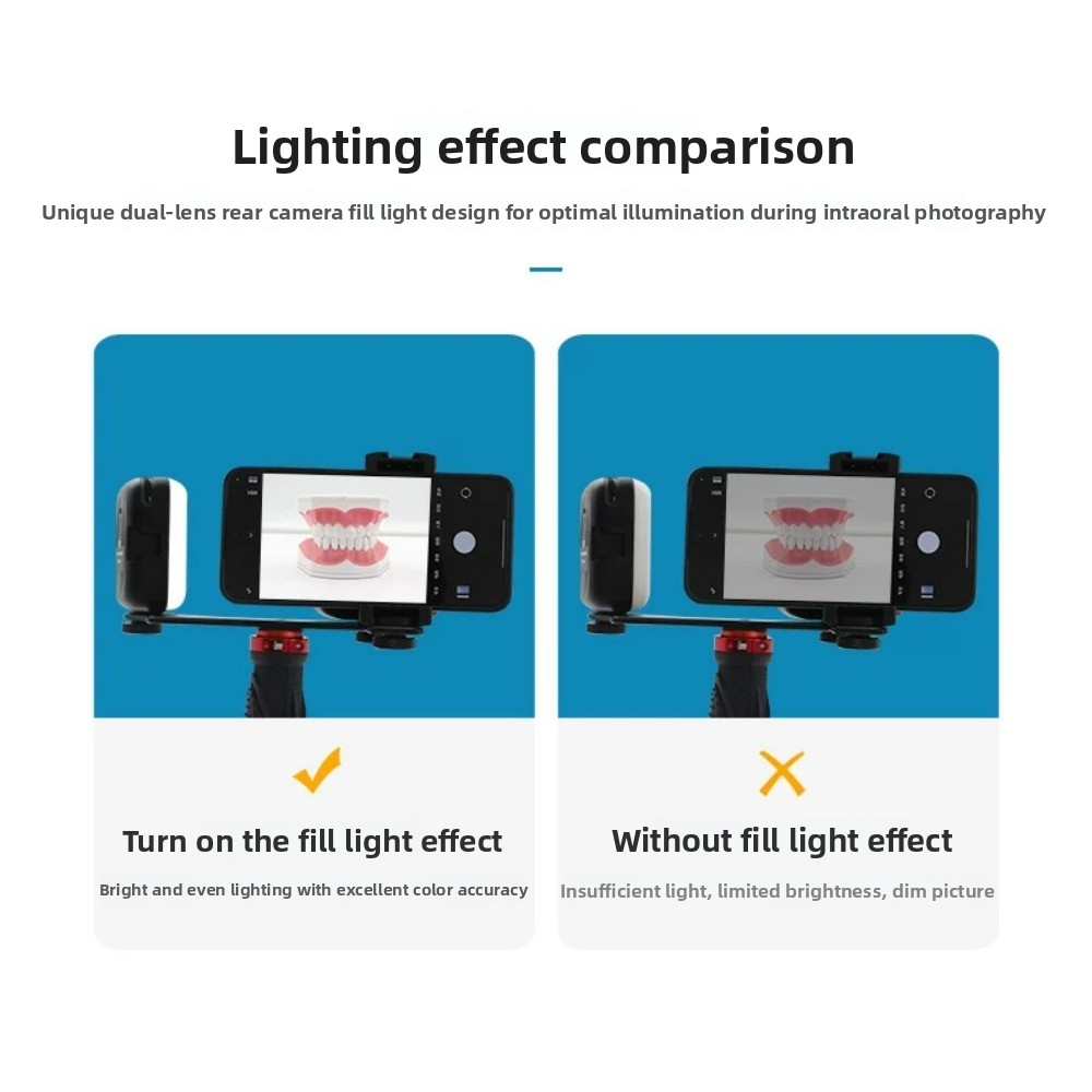Dental Photography Light, Blue - Teeth Whitening Kit 리뷰 및 가격