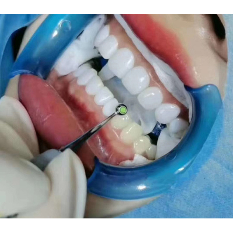 Dental Resin Filling Spatula D - Teeth Whitening Kit 리뷰 및 가격